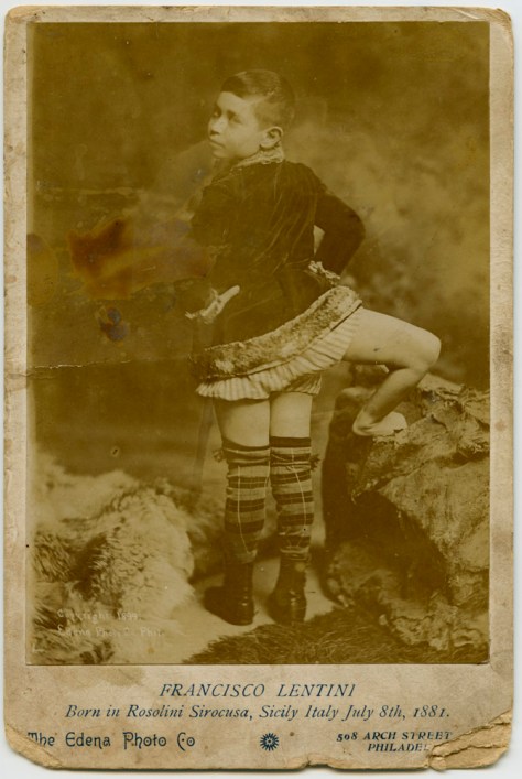 Francesco Lentini, The Three-Legged Boy