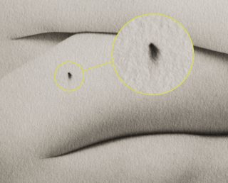 close-up-of-a-black-spot-320x258